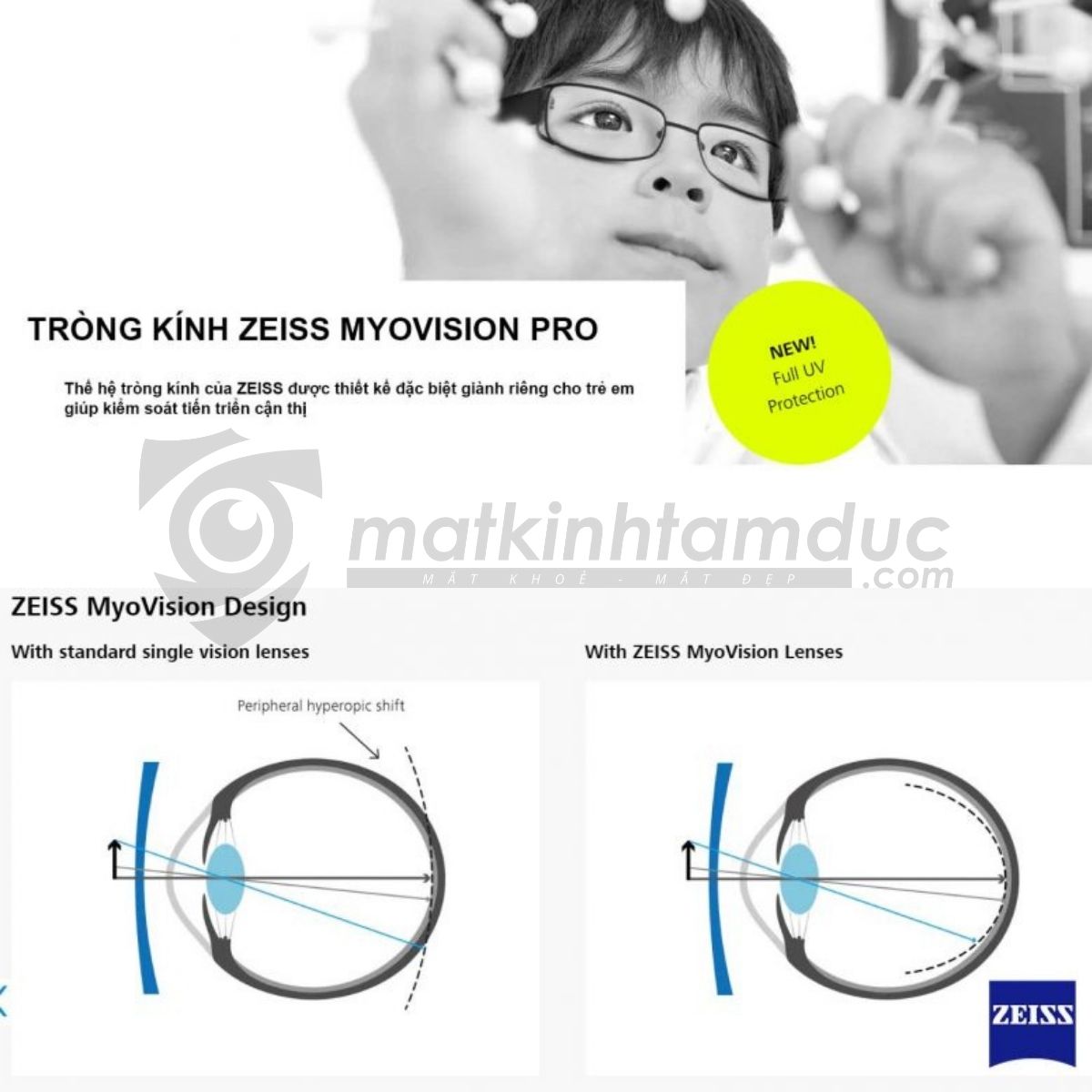 Tròng kính ZEISS MYOVISION PRO - Kiểm soát cận thị trẻ em - Ảnh 9