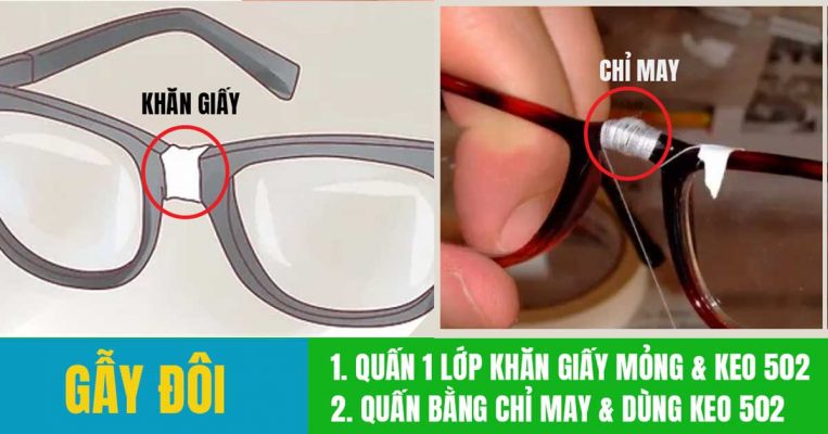 Sử dụng khăn giấy hoặc chỉ may kết hợp keo 502