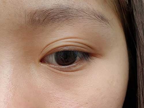 các kiểu mắt