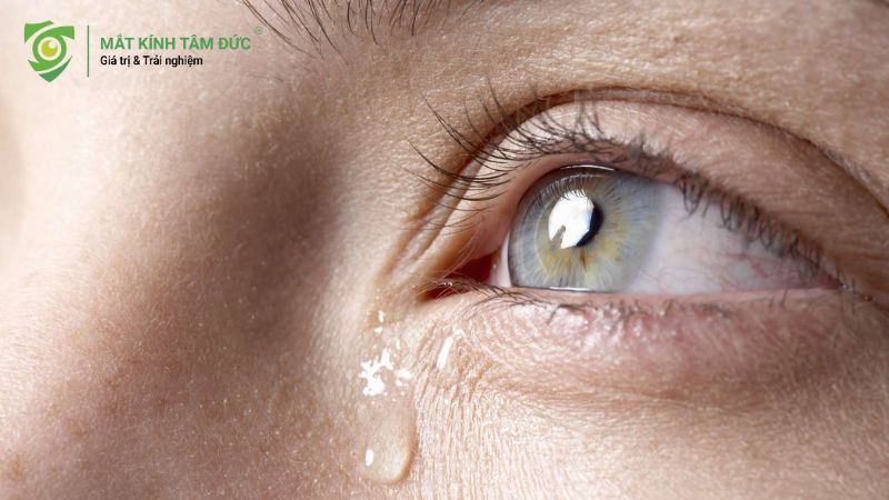 Hình ảnh cận cảnh một đôi mắt rưng rưng nước mắt với bọng mắt sưng nhẹ.