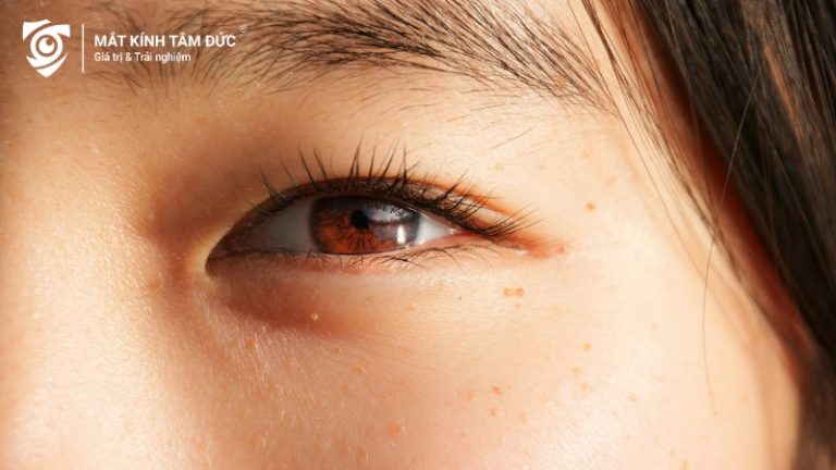 Mắt lươn là gì? Ý nghĩa tướng số và mắt kính phù hợp cho người mắt lươn