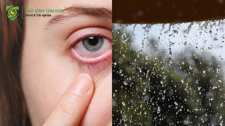 Cẩm nang chăm sóc mắt bảo vệ mắt vào mùa mưa không thể bỏ qua