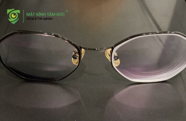 Cận 1 bên mắt có cần đeo kính không? Để lâu có bị nhược thị không?