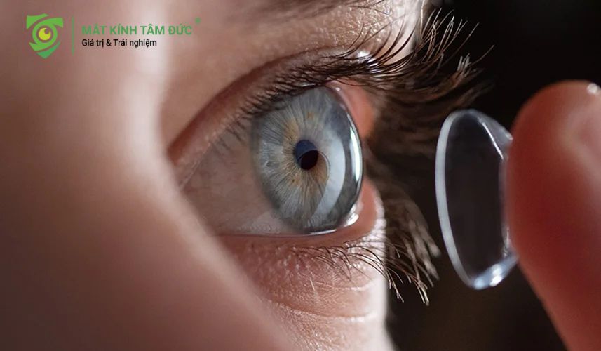 Kính áp tròng ban đêm Ortho-K để định hình lại giác mạc một cách nhẹ nhàng.