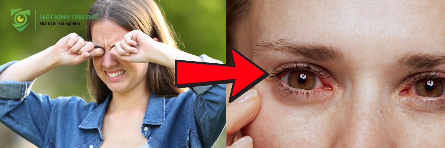 Tại sao tuyệt đối không được dụi mắt khi có bụi bay vào mắt?