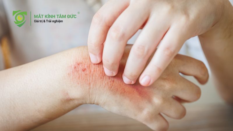 Dầu cá tốt cho mắt cận thị không? Sự thật bạn cần biết 