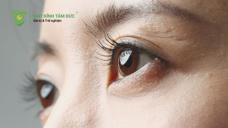 Khoảng cách đồng tử là gì? Cách đo chuẩn nhất